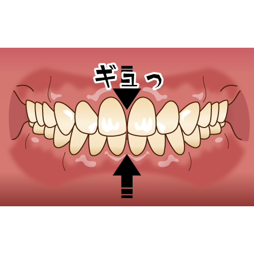 歯の痛みと頭痛が関係？？